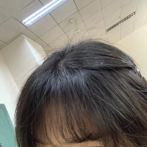 新澳门彩最快开奖记录和频繁洗头脱发是误解与频繁洗头导致脱发